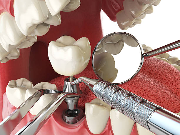 Best Emergency Broken Tooth Repair in Oak Grove, KY